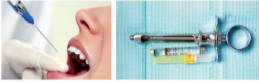 胰島素，牙科麻醉6.png